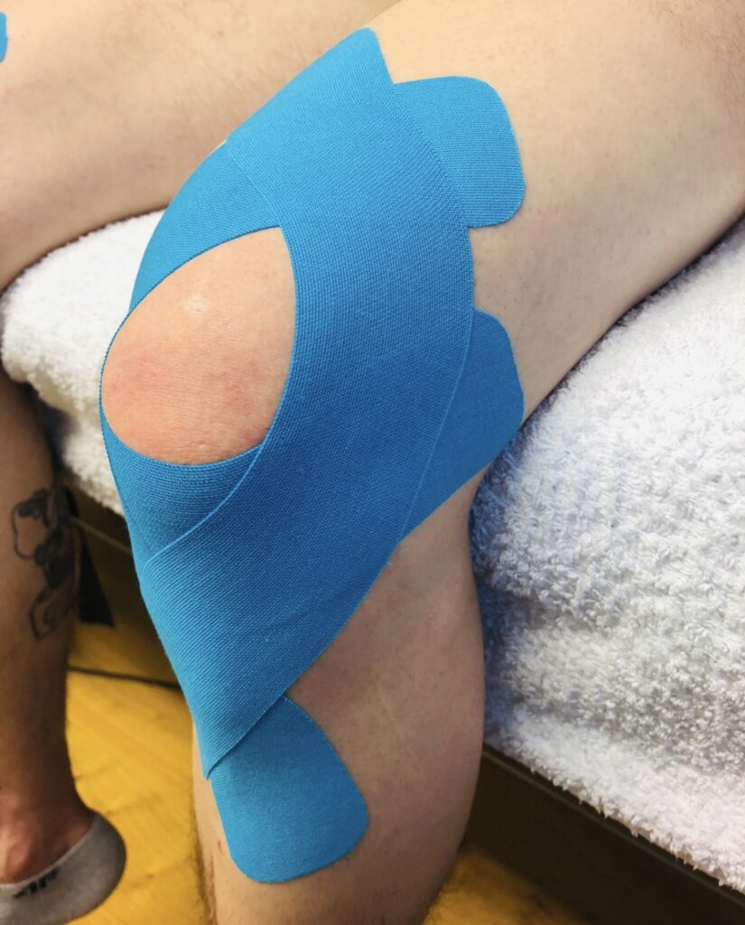 Kinesiology taping