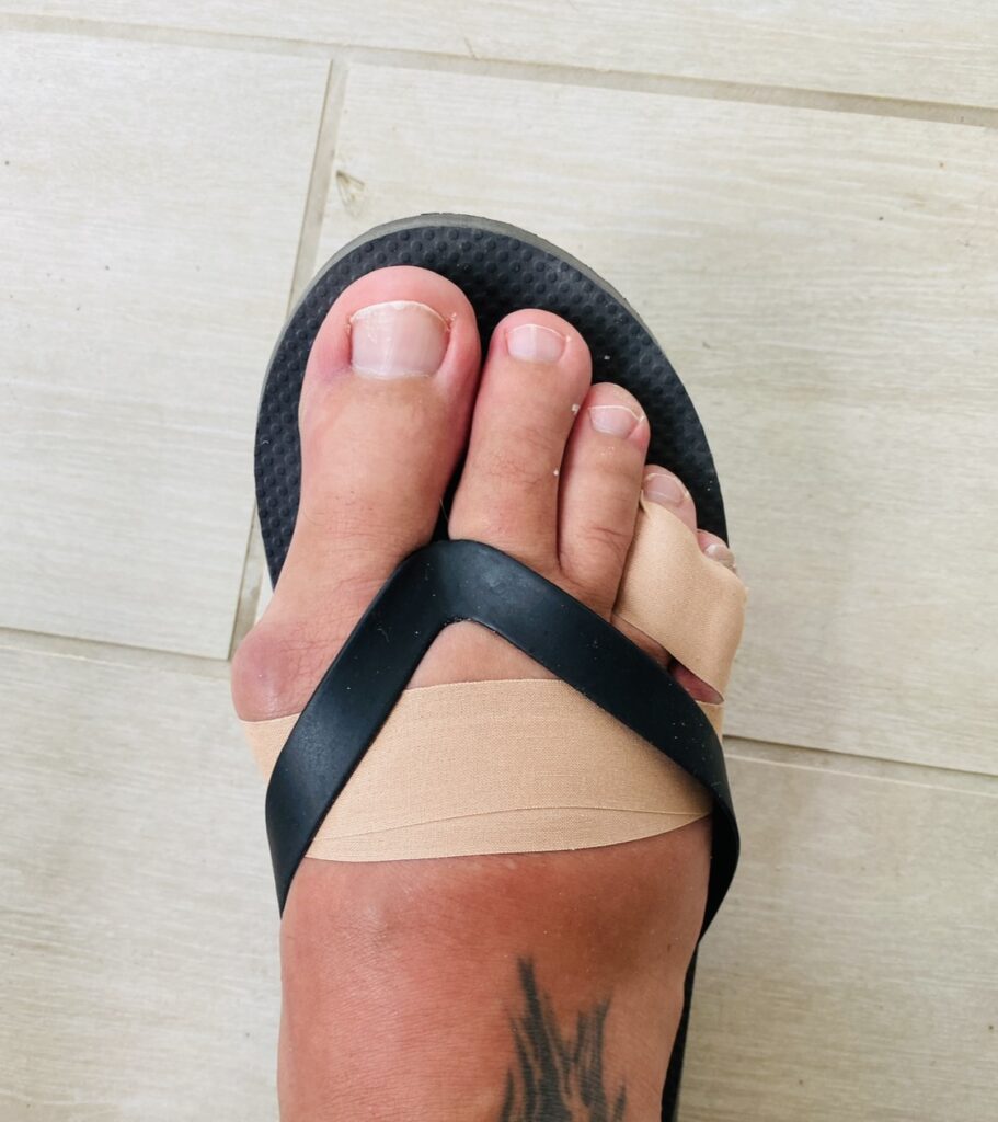 Kinesiology taping